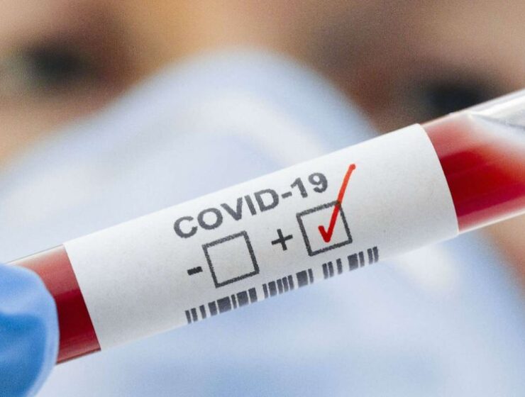 Se incrementa el número de casos de Covid en Cataluña
